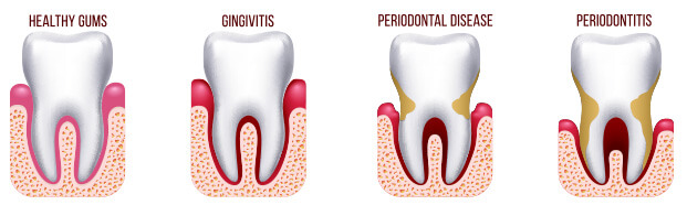 sideimage-teeth sideimage-teeth