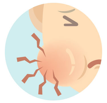 sideimage-tmj sideimage-tmj