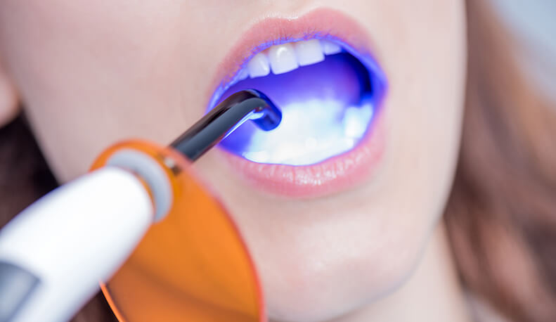 Sealant1